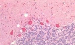SRD5A1 Antibody, Novus Biologicals 50 &mu;g; Unconjugated:Antibodies, Polyclonal